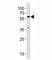 SMAD2 antibody, F53216-0.4ML, NSJ Bioreagents, Western Blot image 