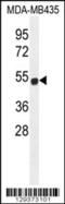 Putative zinc finger protein 286B antibody, 56-012, ProSci, Western Blot image 