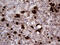 Proteinase 3 antibody, M03863-1, Boster Biological Technology, Immunohistochemistry paraffin image 