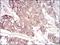 Serpin Family A Member 3 antibody, NBP2-52559, Novus Biologicals, Immunohistochemistry paraffin image 