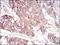 Serpin Family A Member 3 antibody, NBP2-52559, Novus Biologicals, Immunohistochemistry paraffin image 