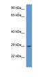 RAB2B, Member RAS Oncogene Family antibody, orb331104, Biorbyt, Western Blot image 