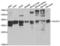Transaldolase 1 antibody, LS-C335703, Lifespan Biosciences, Western Blot image 