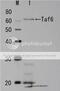 TAF6-like protein antibody, 62-014, BioAcademia Inc, Western Blot image 