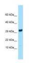 Ribosomal Protein L27 antibody, NBP1-98580, Novus Biologicals, Western Blot image 