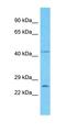 Phospholipid Scramblase Family Member 5 antibody, orb327081, Biorbyt, Western Blot image 