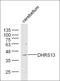 Dynein Axonemal Assembly Factor 5 antibody, orb2384, Biorbyt, Western Blot image 