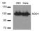 SRBP1 antibody, 79-355, ProSci, Western Blot image 