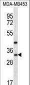 TATA-Box Binding Protein Associated Factor 9b antibody, LS-C161694, Lifespan Biosciences, Western Blot image 
