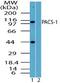 Phosphofurin Acidic Cluster Sorting Protein 1 antibody, PA5-23291, Invitrogen Antibodies, Western Blot image 