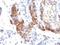 FOXP3 antibody, M00011, Boster Biological Technology, Immunohistochemistry paraffin image 