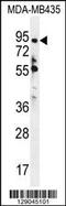 Zinc Finger Protein 605 antibody, 55-864, ProSci, Western Blot image 