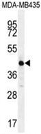 ALX Homeobox 4 antibody, AP50156PU-N, Origene, Western Blot image 