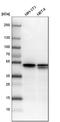 Y-Box Binding Protein 1 antibody, HPA040304, Atlas Antibodies, Western Blot image 