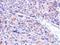 Carbonyl Reductase 1 antibody, GTX100207, GeneTex, Immunohistochemistry paraffin image 