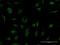 TBC1 Domain Family Member 1 antibody, H00023216-B02P, Novus Biologicals, Immunocytochemistry image 
