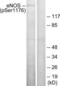 Nitric Oxide Synthase 3 antibody, LS-C117345, Lifespan Biosciences, Western Blot image 