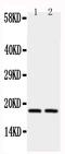 Peptidylprolyl Isomerase A antibody, PA1447, Boster Biological Technology, Western Blot image 