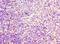 Fms Related Tyrosine Kinase 3 Ligand antibody, LS-C369650, Lifespan Biosciences, Immunohistochemistry paraffin image 