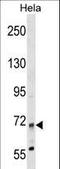 Myotubularin Related Protein 14 antibody, LS-C158328, Lifespan Biosciences, Western Blot image 