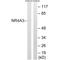 Nuclear Receptor Subfamily 4 Group A Member 3 antibody, A02578, Boster Biological Technology, Western Blot image 