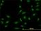 SMAD Family Member 5 antibody, H00004090-M03, Novus Biologicals, Immunofluorescence image 