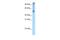 Eukaryotic Translation Initiation Factor 2 Subunit Alpha antibody, PA5-41916, Invitrogen Antibodies, Western Blot image 