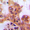 Serum/Glucocorticoid Regulated Kinase 1 antibody, LS-C358312, Lifespan Biosciences, Immunohistochemistry frozen image 