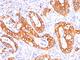 Mucin 1, Cell Surface Associated antibody, NBP2-44665, Novus Biologicals, Immunohistochemistry frozen image 