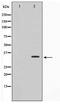 Calcium And Integrin Binding Family Member 3 antibody, TA347585, Origene, Western Blot image 