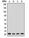 Receptor Accessory Protein 5 antibody, LS-C667969, Lifespan Biosciences, Western Blot image 