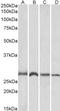 Siah E3 Ubiquitin Protein Ligase 1 antibody, LS-C34634, Lifespan Biosciences, Western Blot image 