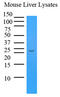 Transthyretin antibody, MBS200188, MyBioSource, Western Blot image 