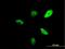 SWI/SNF-related matrix-associated actin-dependent regulator of chromatin subfamily A containing DEAD/H box 1 antibody, H00056916-B01P, Novus Biologicals, Immunofluorescence image 