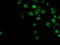 p53 antibody, LS-C786023, Lifespan Biosciences, Immunofluorescence image 