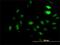 Lysine Acetyltransferase 2A antibody, H00002648-M01, Novus Biologicals, Immunocytochemistry image 