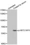 AKT Serine/Threonine Kinase 2 antibody, abx000095, Abbexa, Western Blot image 