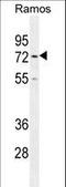 Hyaluronan Mediated Motility Receptor antibody, LS-C164940, Lifespan Biosciences, Western Blot image 