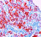 MCSP antibody, DM079, Origene, Immunohistochemistry paraffin image 