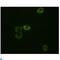 ABL Proto-Oncogene 2, Non-Receptor Tyrosine Kinase antibody, LS-C812399, Lifespan Biosciences, Western Blot image 