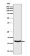 Synuclein Alpha antibody, P00215-2, Boster Biological Technology, Western Blot image 