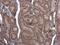 Mitogen-Activated Protein Kinase Kinase Kinase 3 antibody, GTX107945, GeneTex, Immunohistochemistry paraffin image 