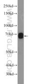 KH Domain Containing 4, Pre-MRNA Splicing Factor antibody, 25419-1-AP, Proteintech Group, Western Blot image 