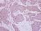 Mitogen-Activated Protein Kinase Kinase 5 antibody, NBP2-17270, Novus Biologicals, Immunohistochemistry paraffin image 