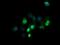 Zinc Finger And SCAN Domain Containing 21 antibody, MA5-26251, Invitrogen Antibodies, Immunocytochemistry image 