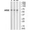 Arylsulfatase E antibody, A10294, Boster Biological Technology, Western Blot image 