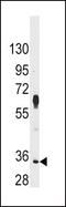 Pim-2 Proto-Oncogene, Serine/Threonine Kinase antibody, PA5-15125, Invitrogen Antibodies, Western Blot image 