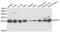 Glutathione S-Transferase Pi 1 antibody, abx004353, Abbexa, Western Blot image 