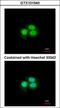 Musashi RNA Binding Protein 1 antibody, GTX101540, GeneTex, Immunocytochemistry image 
