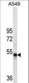 RuvB Like AAA ATPase 1 antibody, LS-C158907, Lifespan Biosciences, Western Blot image 